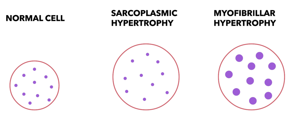 Picture showing difference between sarcoplasmic and myofibrillar hypertrophy. Sarcoplasmic hypertrophy is represented by more sarcoplasm, but the same amount and size of myofibrils as a normal cell. Myofibrillar hypertrophy is represented by a cell with larger myofibrils than the normal cell.